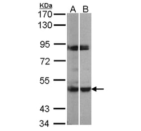 PRAK antibody from Signalway Antibody (22757) - Antibodies.com
