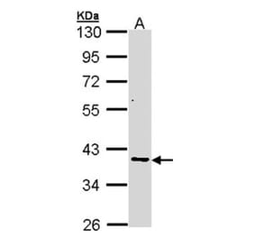 AKR7 antibody from Signalway Antibody (22774) - Antibodies.com