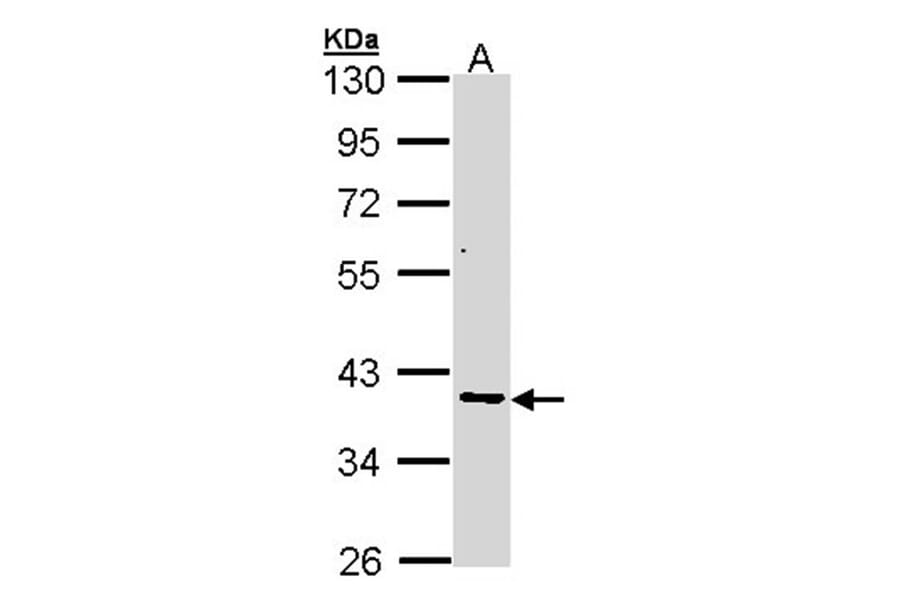 AKR7 antibody from Signalway Antibody (22774) - Antibodies.com