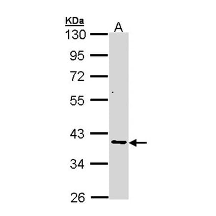 AKR7 antibody from Signalway Antibody (22774) - Antibodies.com