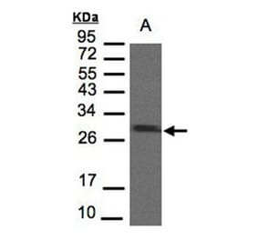 SDHB antibody from Signalway Antibody (22803) - Antibodies.com
