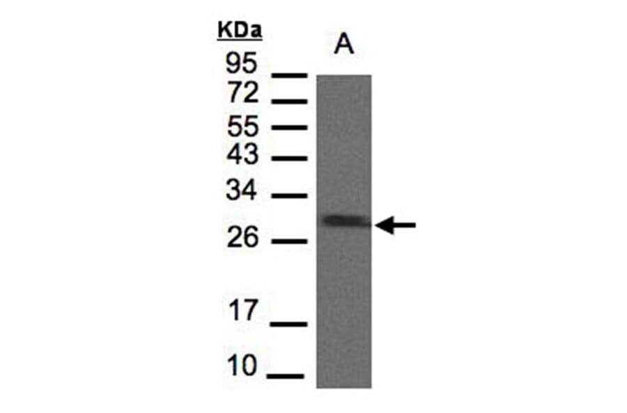 SDHB antibody from Signalway Antibody (22803) - Antibodies.com