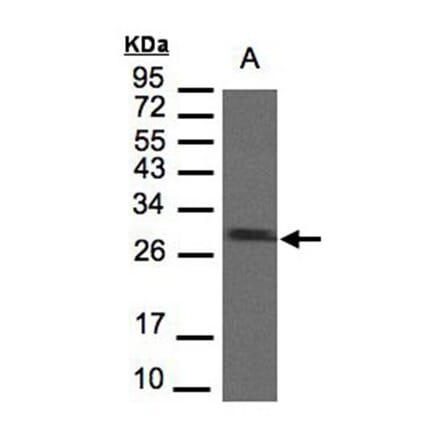 SDHB antibody from Signalway Antibody (22803) - Antibodies.com