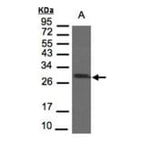 SDHB antibody from Signalway Antibody (22803) - Antibodies.com