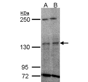 TYK2 antibody from Signalway Antibody (22852) - Antibodies.com