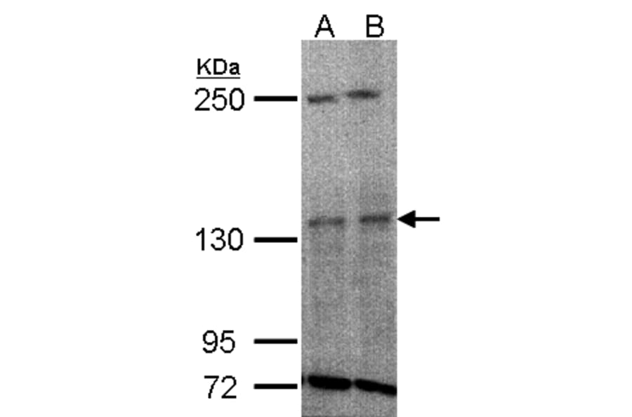 TYK2 antibody from Signalway Antibody (22852) - Antibodies.com