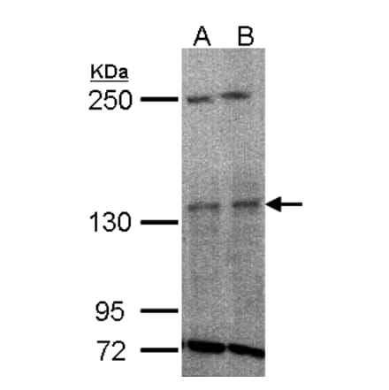 TYK2 antibody from Signalway Antibody (22852) - Antibodies.com