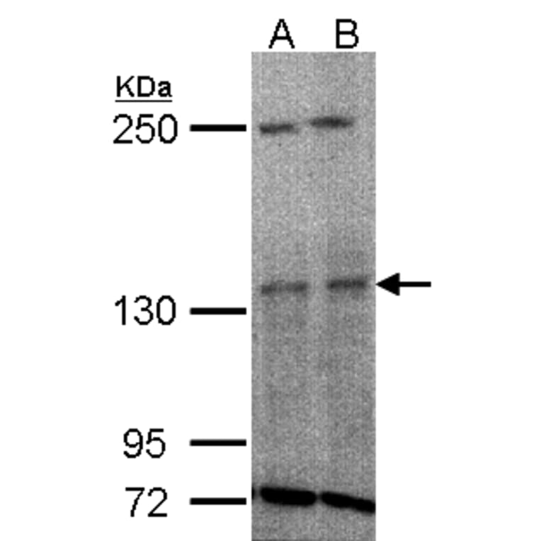 TYK2 antibody from Signalway Antibody (22852) - Antibodies.com