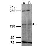 TYK2 antibody from Signalway Antibody (22852) - Antibodies.com