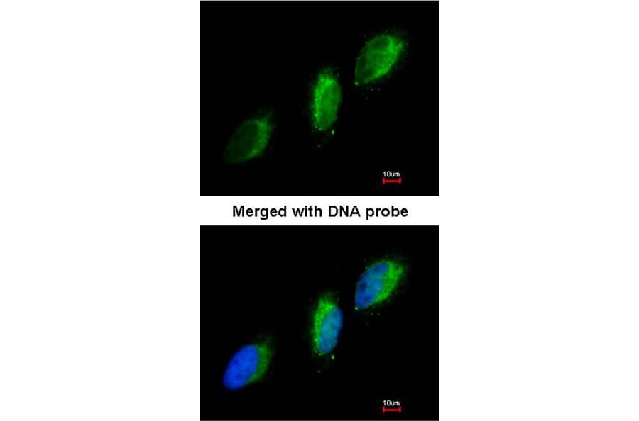 Immunofluorescence - TYK2 antibody from Signalway Antibody (22852) - Antibodies.com