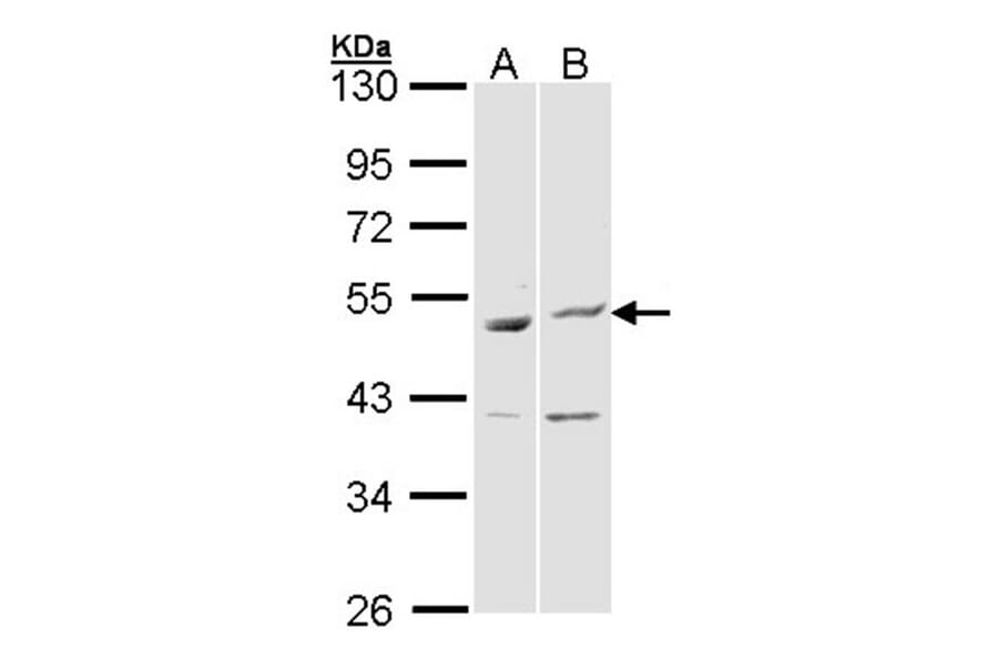 BAG5 antibody from Signalway Antibody (22869) - Antibodies.com