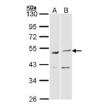 BAG5 antibody from Signalway Antibody (22869) - Antibodies.com