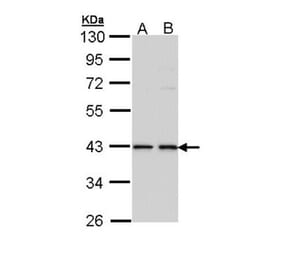 E2F1 antibody from Signalway Antibody (22881) - Antibodies.com