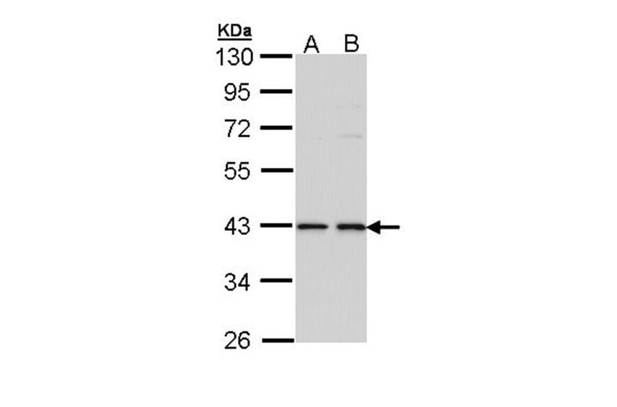 E2F1 antibody from Signalway Antibody (22881) - Antibodies.com