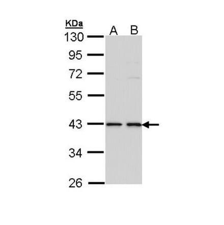 E2F1 antibody from Signalway Antibody (22881) - Antibodies.com