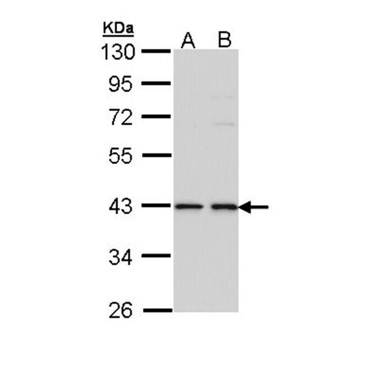 E2F1 antibody from Signalway Antibody (22881) - Antibodies.com