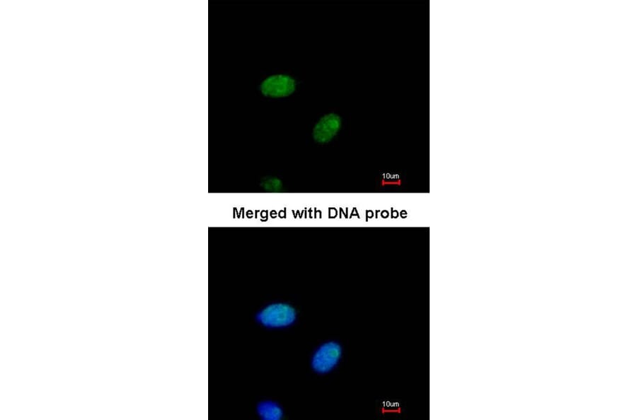 Immunofluorescence - E2F1 antibody from Signalway Antibody (22881) - Antibodies.com