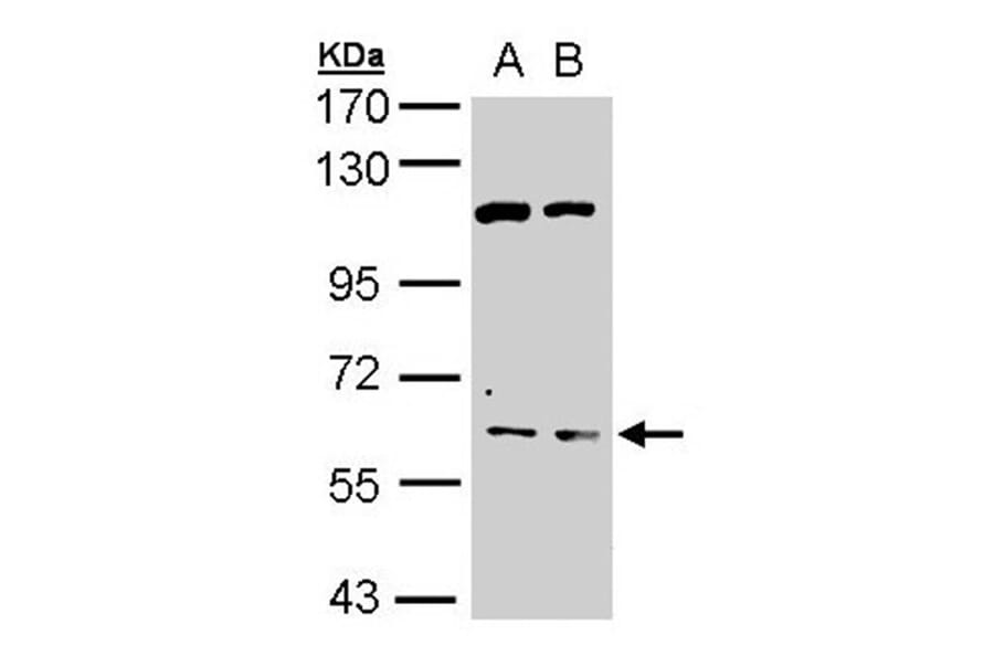 AChE antibody from Signalway Antibody (22892) - Antibodies.com