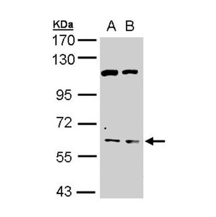 AChE antibody from Signalway Antibody (22892) - Antibodies.com