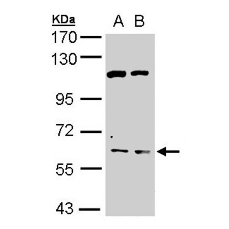 AChE antibody from Signalway Antibody (22892) - Antibodies.com