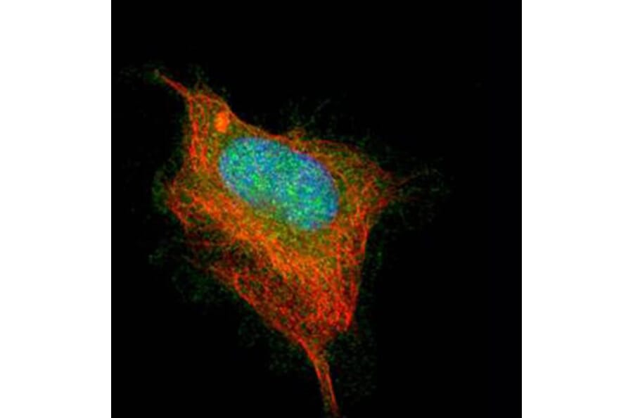 AChE antibody from Signalway Antibody (22893) - Antibodies.com