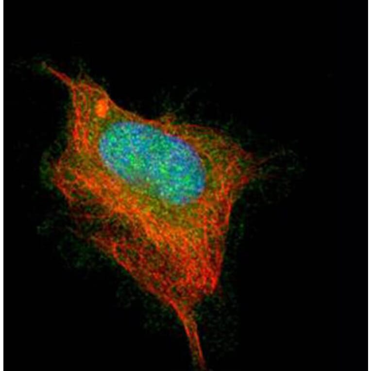 AChE antibody from Signalway Antibody (22893) - Antibodies.com