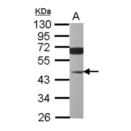 JNK1 antibody from Signalway Antibody (22928) - Antibodies.com