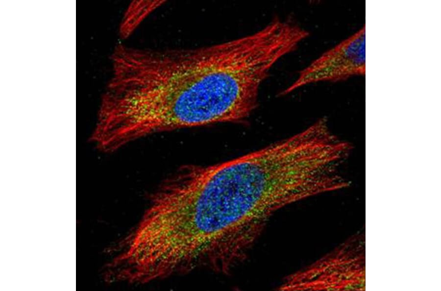 JNK1 antibody from Signalway Antibody (22928) - Antibodies.com