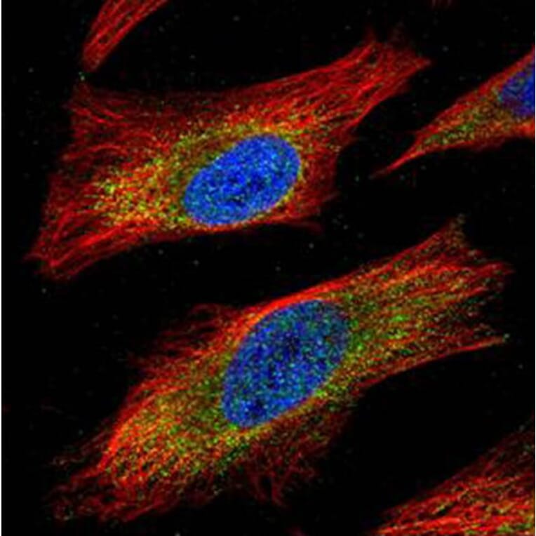 JNK1 antibody from Signalway Antibody (22928) - Antibodies.com