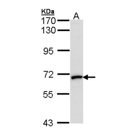 MMP2 antibody from Signalway Antibody (23042) - Antibodies.com