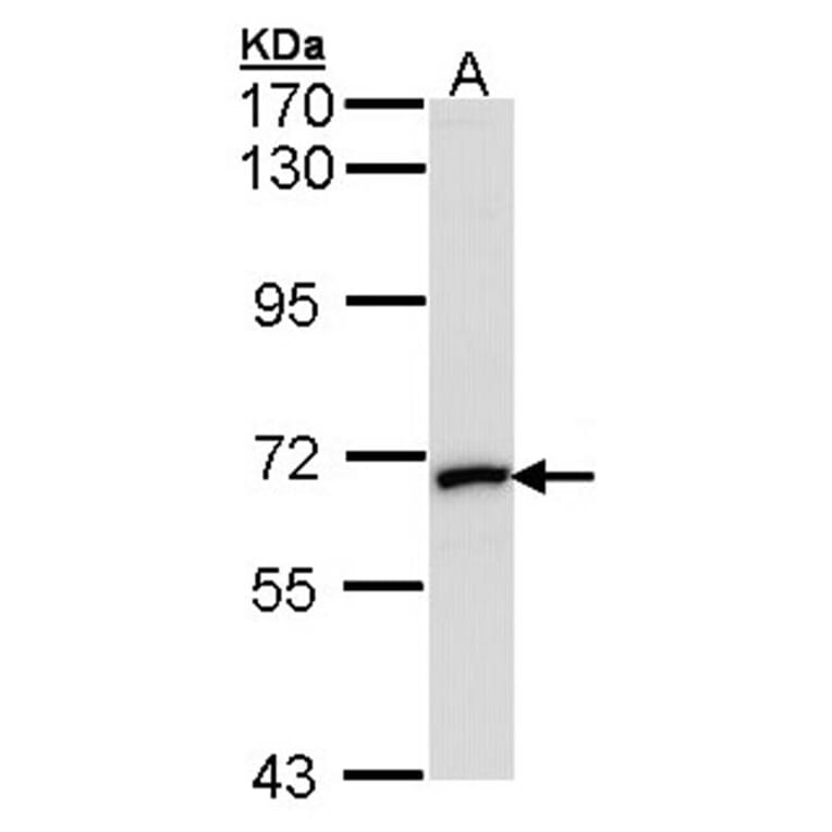 MMP2 antibody from Signalway Antibody (23042) - Antibodies.com