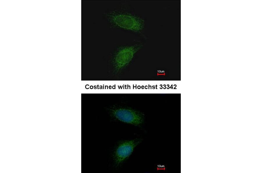 Immunofluorescence - MMP2 antibody from Signalway Antibody (23042) - Antibodies.com