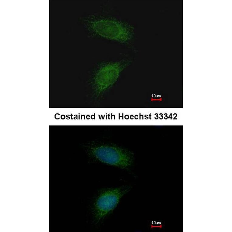 Immunofluorescence - MMP2 antibody from Signalway Antibody (23042) - Antibodies.com