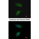 Immunofluorescence - MMP2 antibody from Signalway Antibody (23042) - Antibodies.com