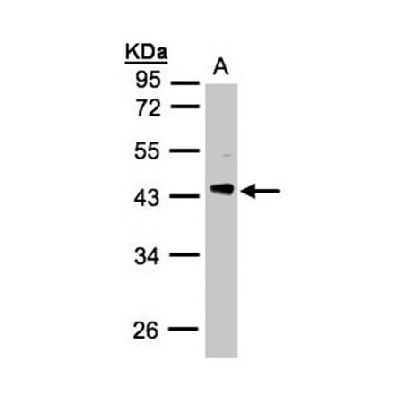 PHLP antibody from Signalway Antibody (23047) - Antibodies.com