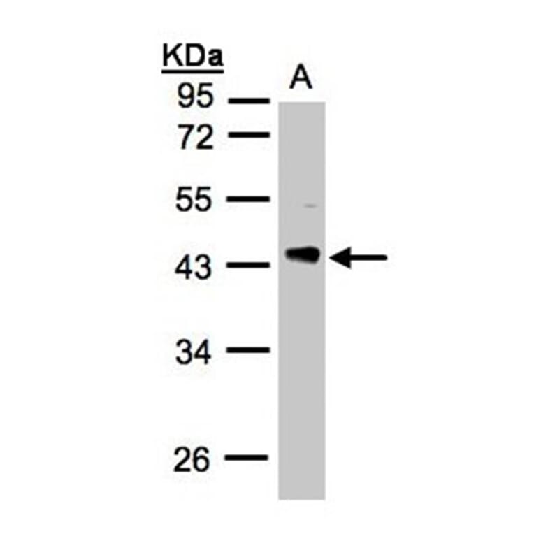 PHLP antibody from Signalway Antibody (23047) - Antibodies.com