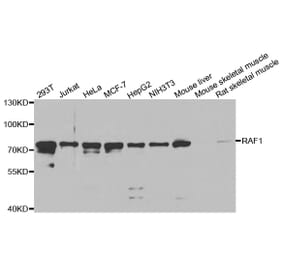 Western blot - RAF1 Antibody from Signalway Antibody (32022) - Antibodies.com