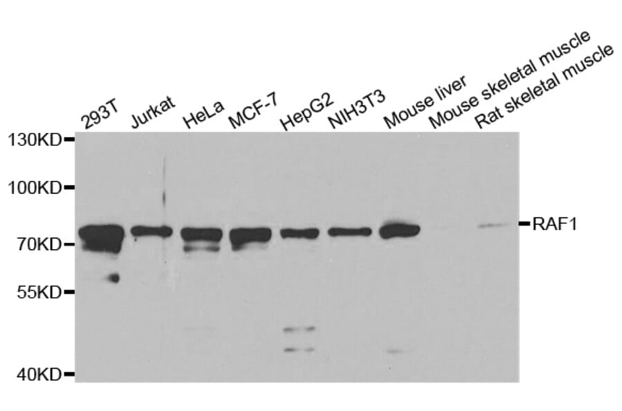 Western blot - RAF1 Antibody from Signalway Antibody (32022) - Antibodies.com