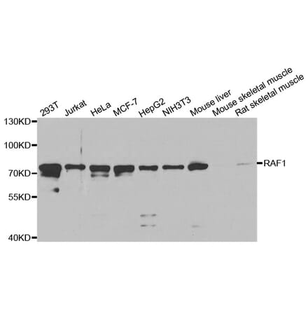 Western blot - RAF1 Antibody from Signalway Antibody (32022) - Antibodies.com