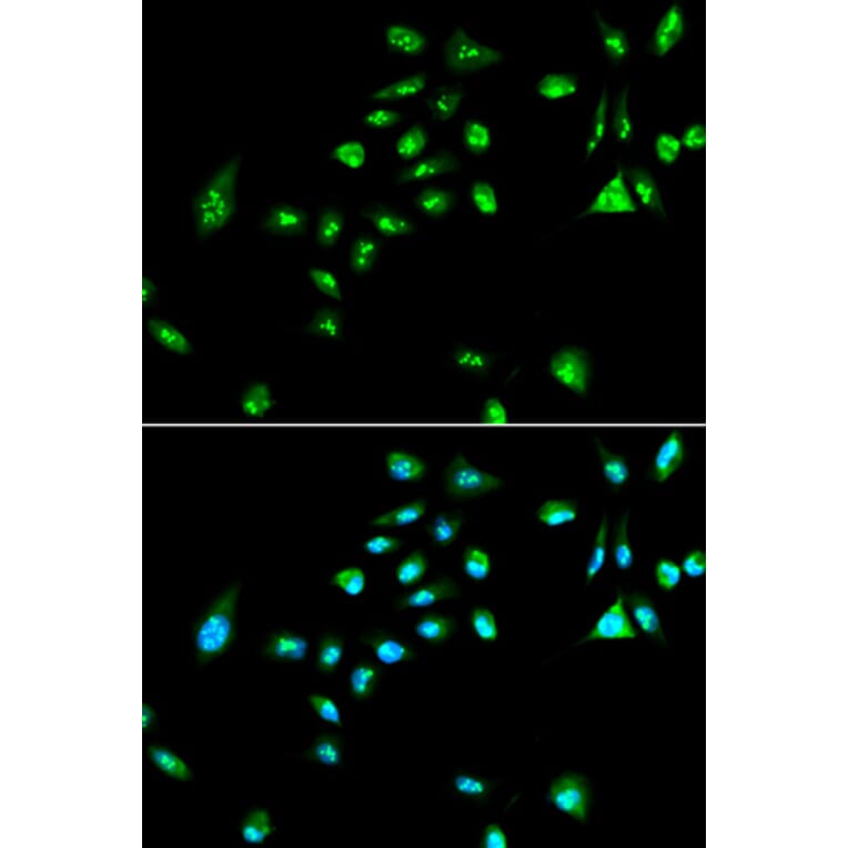 Immunofluorescence - RAF1 Antibody from Signalway Antibody (32022) - Antibodies.com
