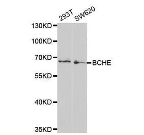 Western blot - BCHE Antibody from Signalway Antibody (32284) - Antibodies.com
