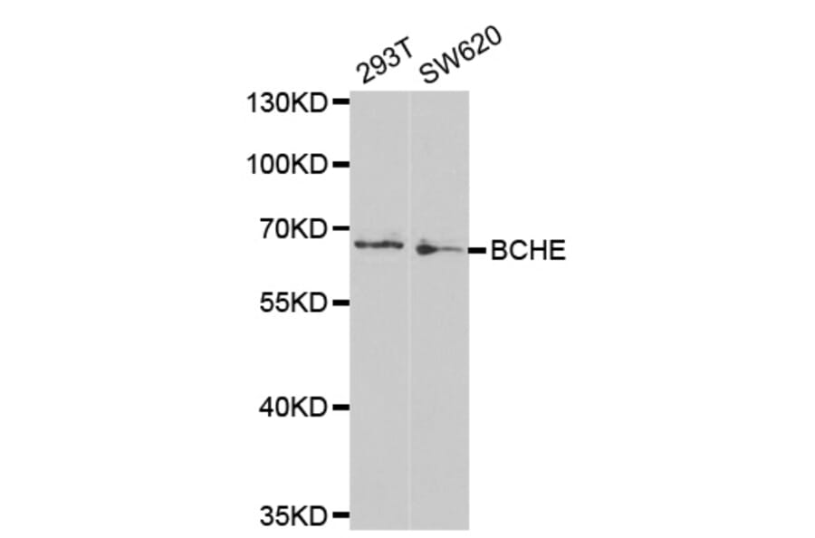 Western blot - BCHE Antibody from Signalway Antibody (32284) - Antibodies.com