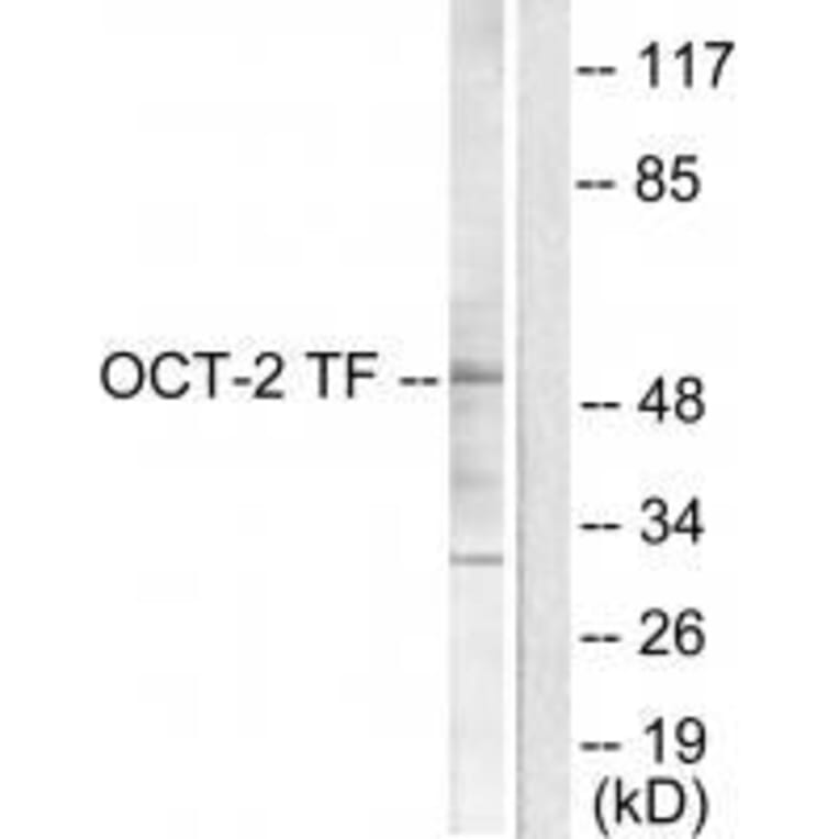 Western blot - OCT2 Antibody from Signalway Antibody (33453) - Antibodies.com