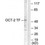 Western blot - OCT2 Antibody from Signalway Antibody (33453) - Antibodies.com