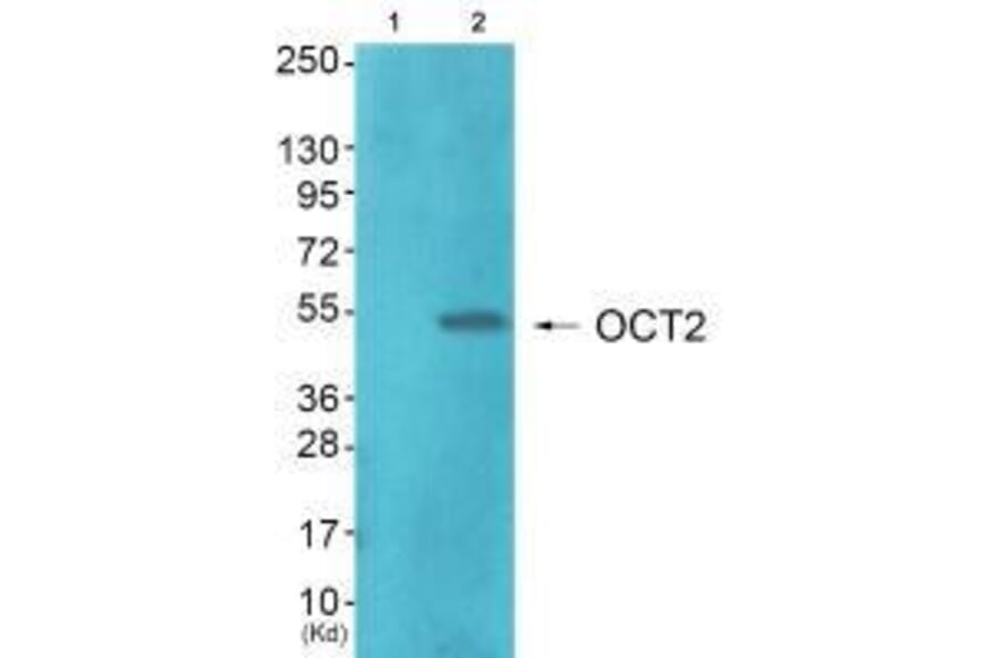 Western blot - OCT2 Antibody from Signalway Antibody (33453) - Antibodies.com