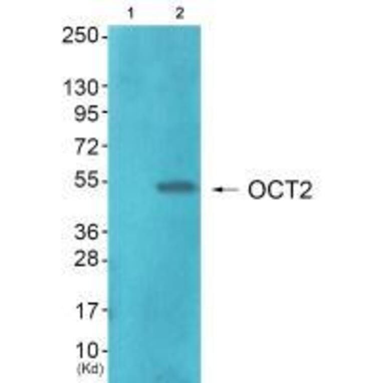 Western blot - OCT2 Antibody from Signalway Antibody (33453) - Antibodies.com