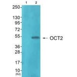 Western blot - OCT2 Antibody from Signalway Antibody (33453) - Antibodies.com