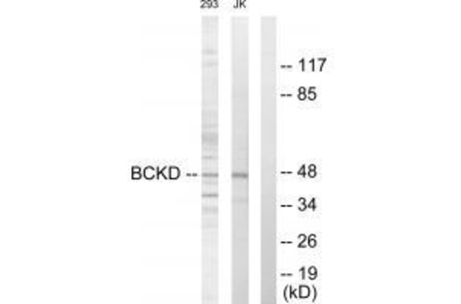 Western blot - BCKD Antibody from Signalway Antibody (33570) - Antibodies.com