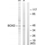 Western blot - BCKD Antibody from Signalway Antibody (33570) - Antibodies.com