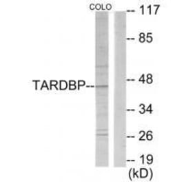 Western blot - TBX1 Antibody from Signalway Antibody (33584) - Antibodies.com